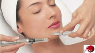 1, 2 o 3 sesiones de peeling de tratamiento